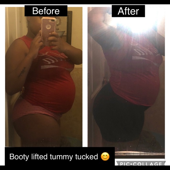 Shapewear (Booty lifting/Tummy tuck) - Picture 6 of 10